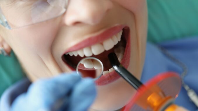 Zahnbleaching - wie sinnvoll ist es?