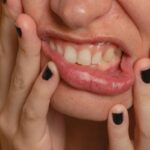 Weshalb verlieren Frauen manchmal Zähne in der Schwangerschaft?