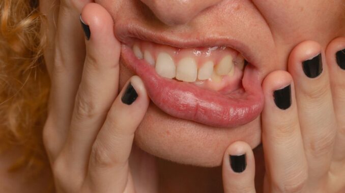 Weshalb verlieren Frauen manchmal Zähne in der Schwangerschaft?